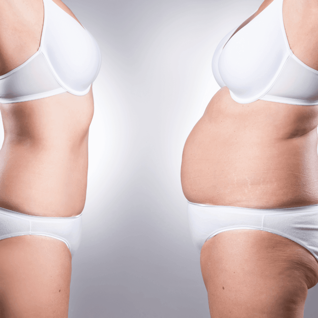 body treatments