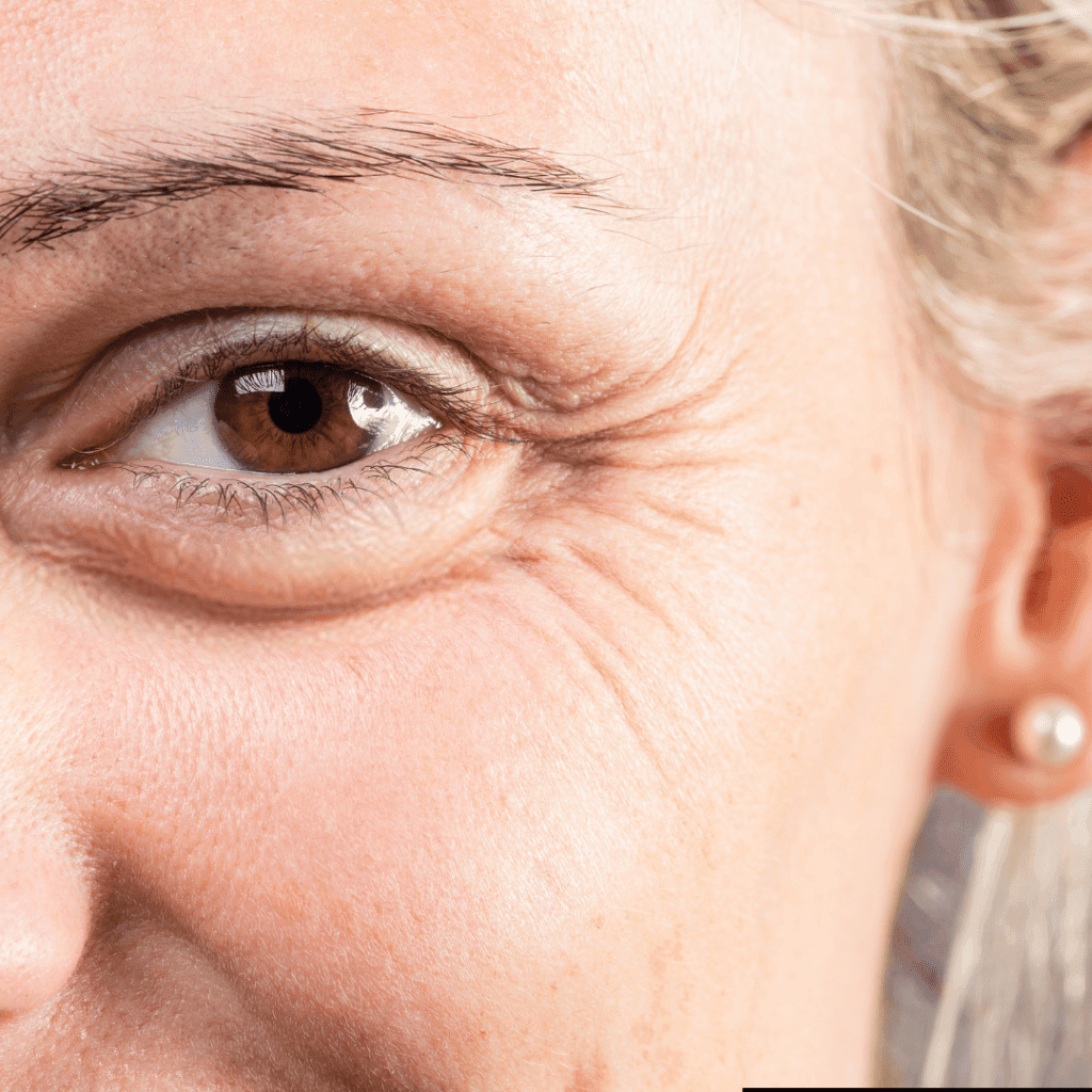 Microneedling with Dermapen make face Vampire Facial treatment good