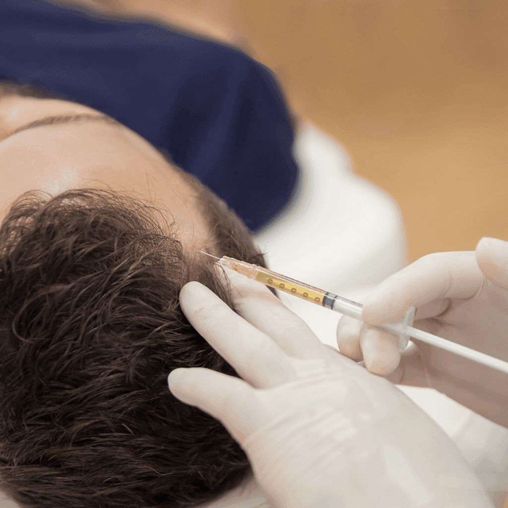 prp hair treatment