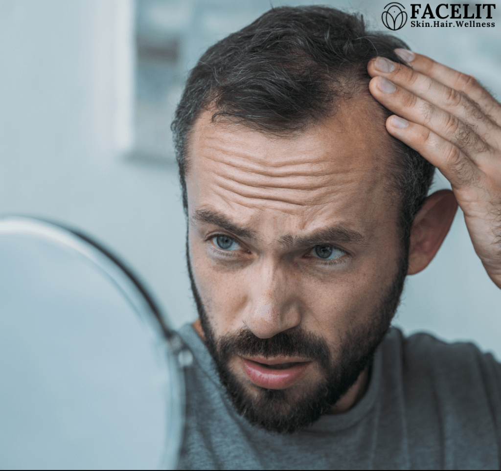 Best Hair Loss Treatment in Bangalore