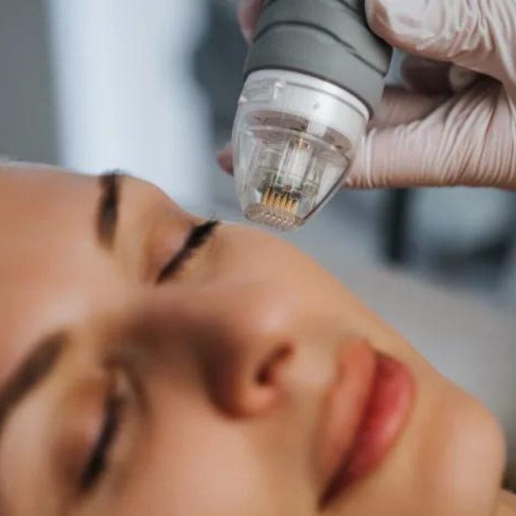 best mnrf treatment at facelit clinic