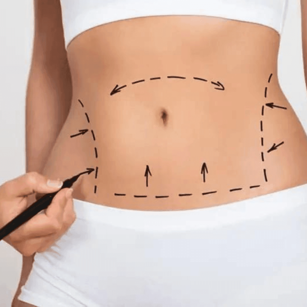 cm slim treatment