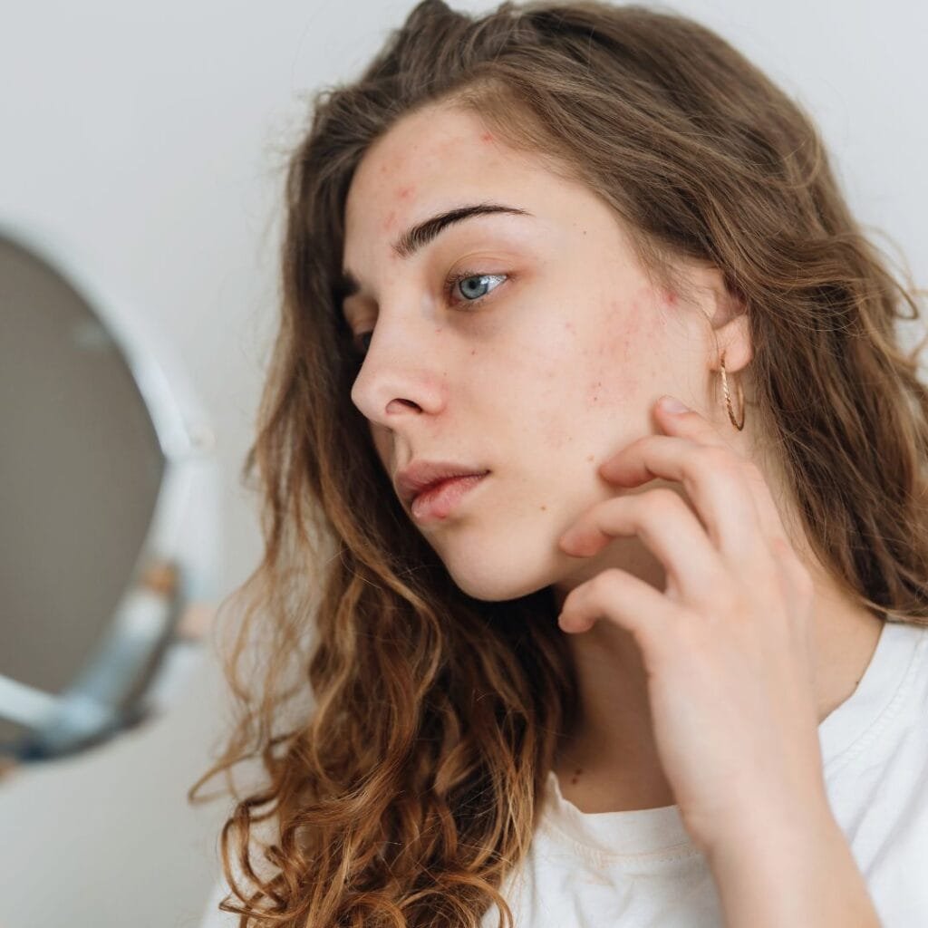Exosomes Skin Treatment