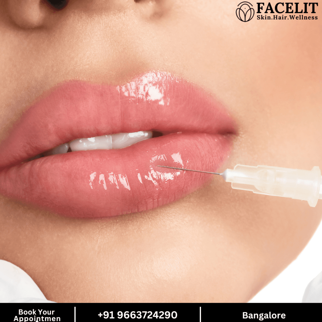 Best lip fillers in Bangalore