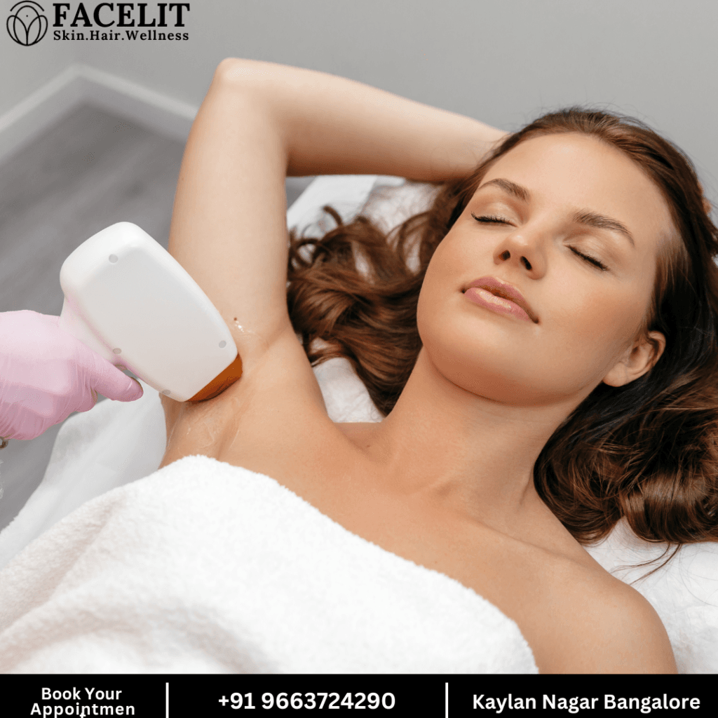 Laser Hair Removal