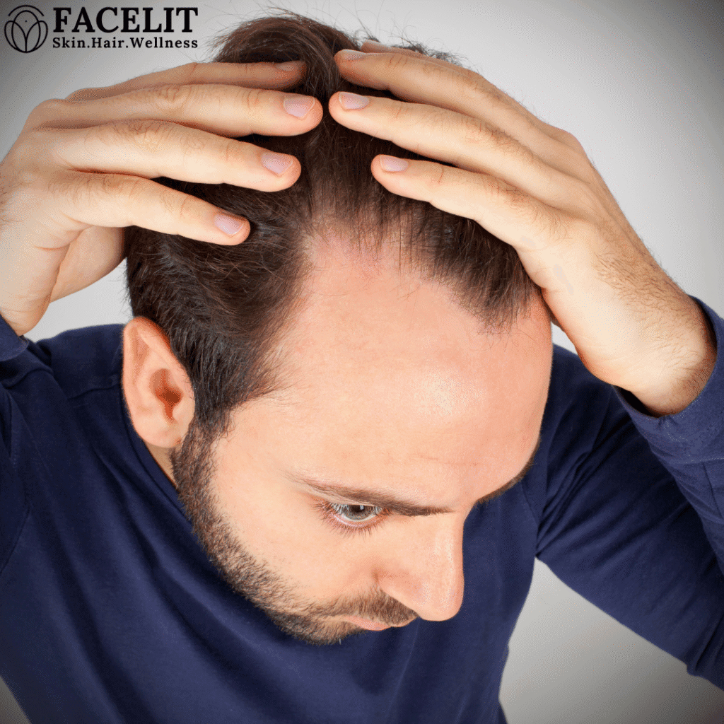 Hair Loss Symptoms Causes