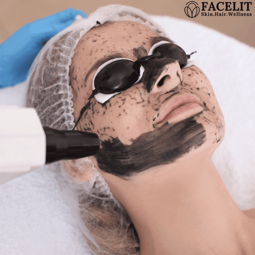 Hollywood Laser Peel
