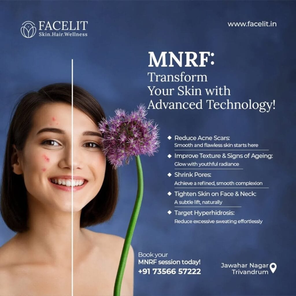 MNRF: Why It is a Popular Treatment