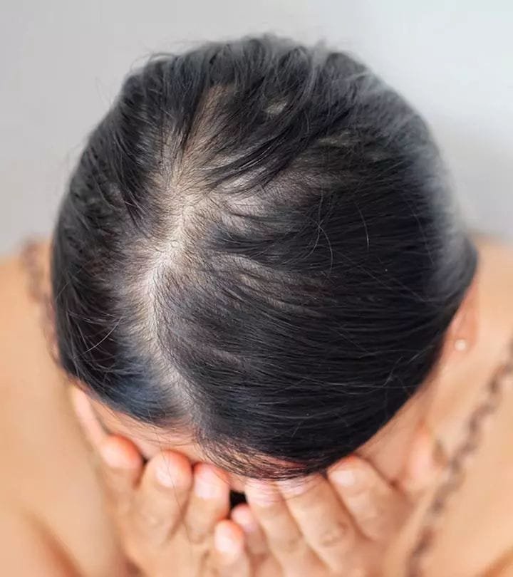 Best Hair Clinic in Guruvayur